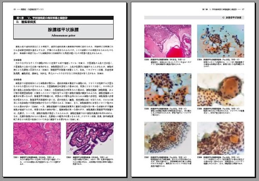 臨床細胞診断学アトラス 51GGqCaJLYL._AC_SY200_QL15_.jpg